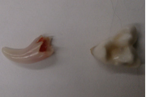 ラブラドールの乳歯の写真